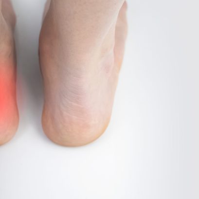 An orthopedic doctor examines a woman's leg. Achilles tendon and ankle diseases. Inflammation of the heel and foot, achillobursitis and achillotomy, rheumatism, tendon rupture